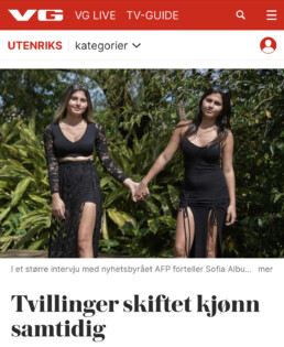 Tvillinger skifter kjønn